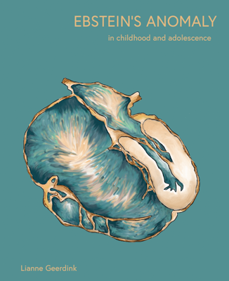 Ebstein’s anomaly in childhood and adolescence Ebstein’s anomaly in childhood and adolescence