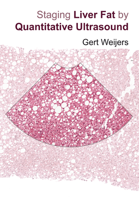 Staging liver fat by quantitative ultrasound Staging liver fat by quantitative ultrasound