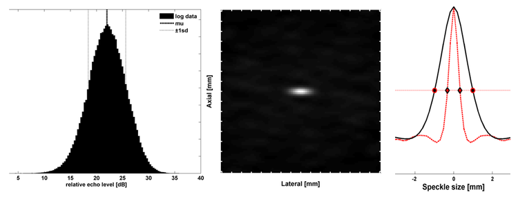 750px MUSIC caus ROI parameters