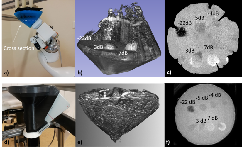 825px Breast 3D quant