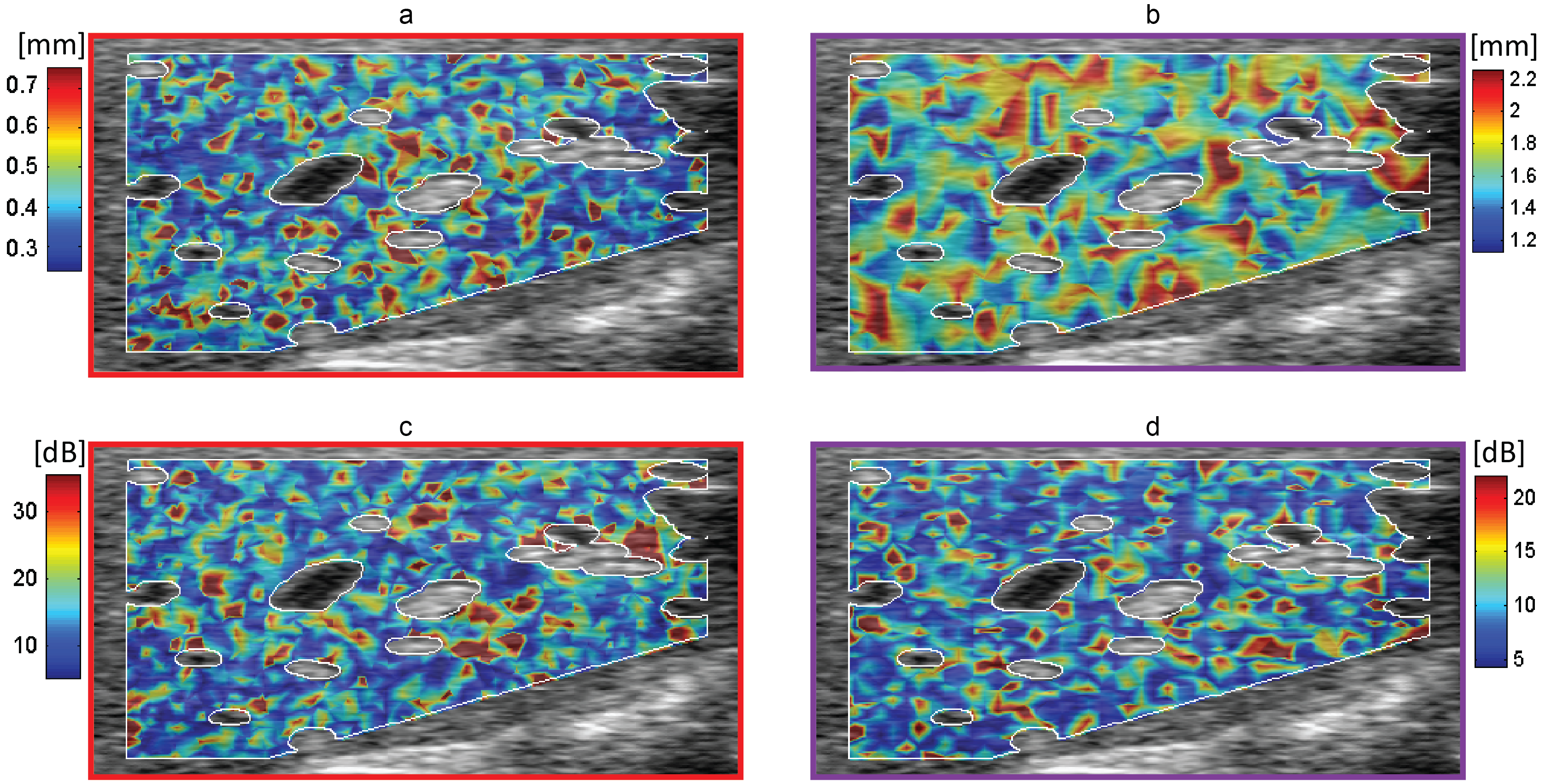 MUSIC caus param texture